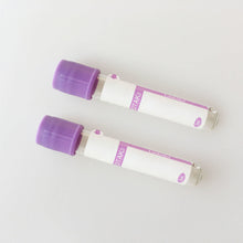 Load image into Gallery viewer, LundaMed 100pcs Lab Plastic Frozen Test Tubes Vial Seal Cap Container for Laboratory School hospitals